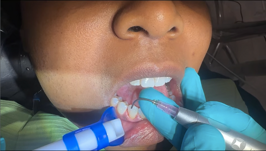 LinguaGuard being used on a patient